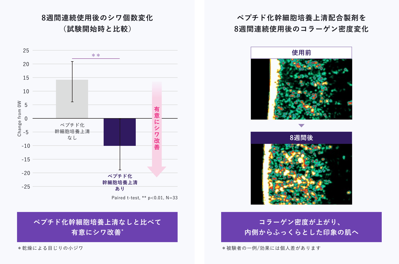 8週間連続使用後のシワ個数変化のグラフ。ペプチド化幹細胞培養上清なしと比べて有意にシワが改善（Paired t-test, ** p<0.01, N=33）。あわせて使用前と8週間後のコラーゲン密度の比較画像では、コラーゲン密度が上がり内側からふっくらとした印象の肌へ変化。